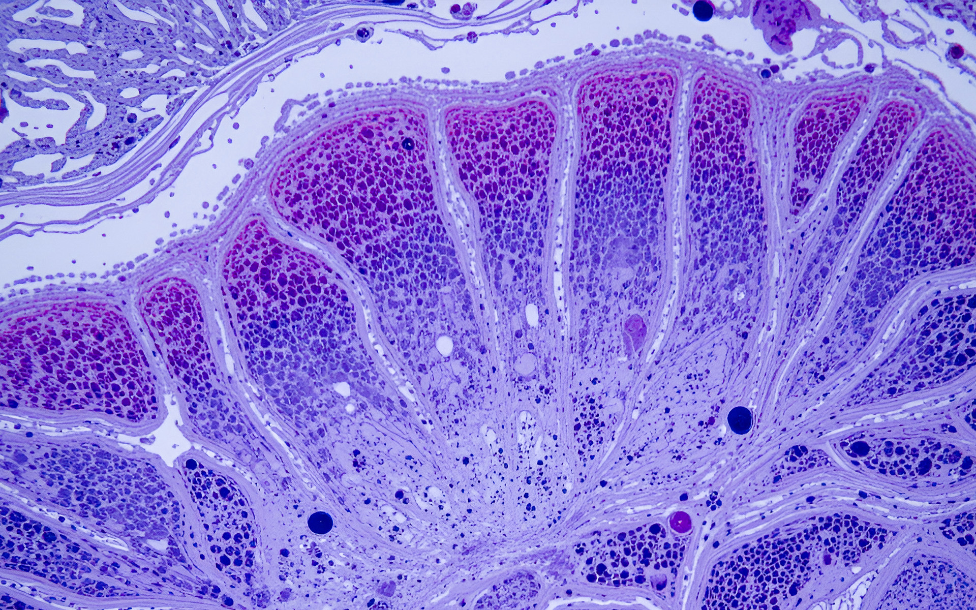 Pathologie, Ärzte, PACS, LABBOARD, Pathologie-Cockpit, Querschnitt Tumor